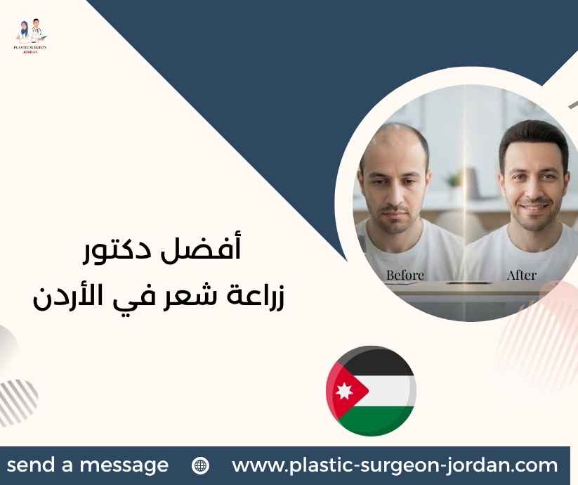 أفضل دكتور زراعة شعر في الأردن أفضل دكتور زراعة شعر في الأردن