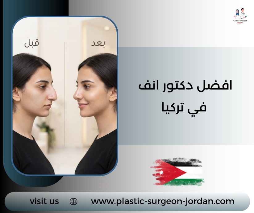 افضل دكتور انف في تركيا