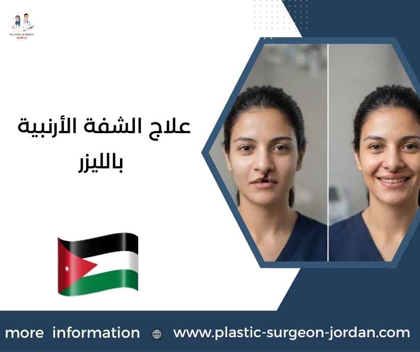 علاج الشفة الأرنبية بالليزر