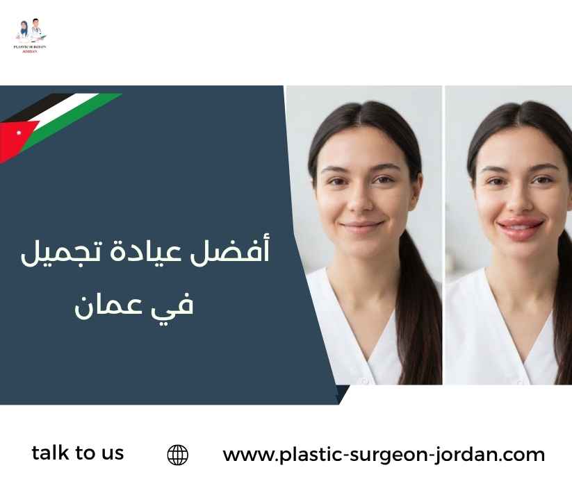 أفضل عيادة تجميل في عمان أفضل عيادة تجميل في عمان