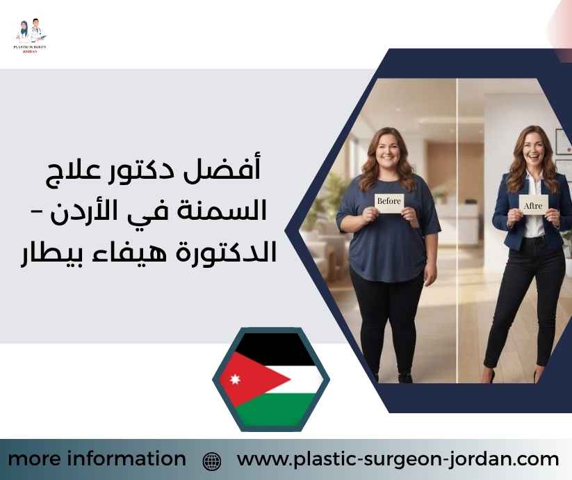 أفضل دكتور علاج السمنة في الأردن – الدكتورة هيفاء بيطار