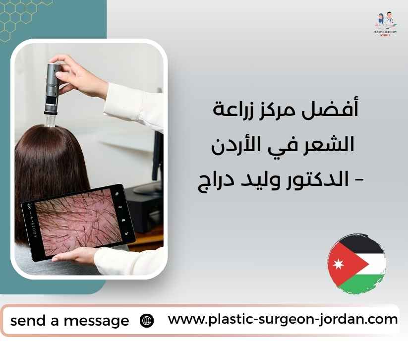 أفضل مركز زراعة الشعر في الأردن – الدكتور وليد دراج أفضل مركز زراعة الشعر في الأردن – الدكتور وليد دراج
