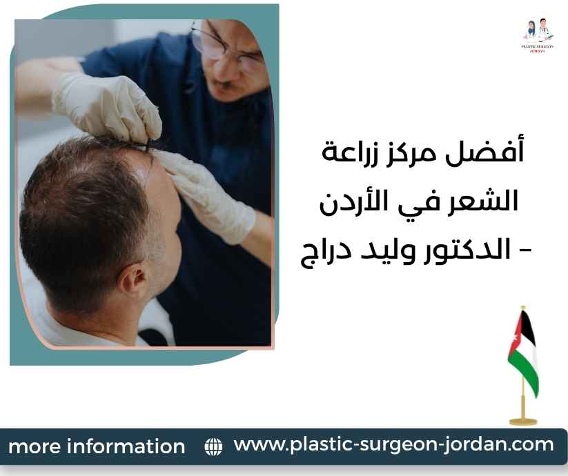 أفضل مركز زراعة الشعر في الأردن – الدكتور وليد دراج أفضل مركز زراعة الشعر في الأردن – الدكتور وليد دراج