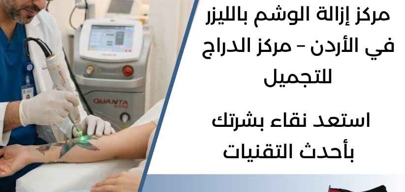 مركز إزالة الوشم بالليزر في الأردن