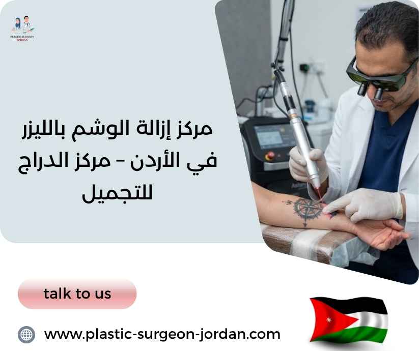 مركز إزالة الوشم بالليزر في الأردن