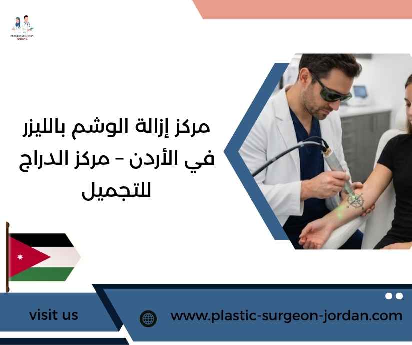 مركز إزالة الوشم بالليزر في الأردن