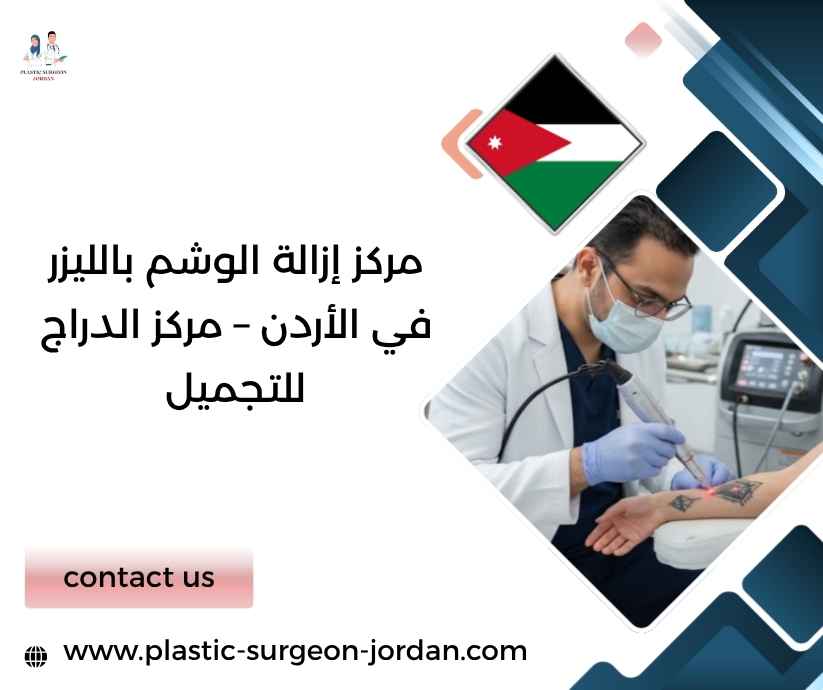 مركز إزالة الوشم بالليزر في الأردن