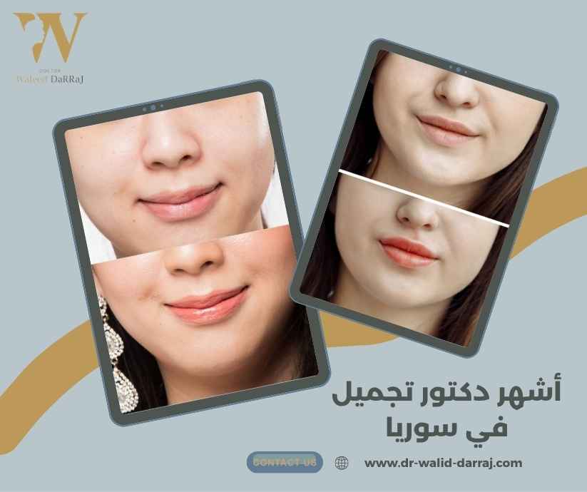 أشهر دكتور تجميل في سوريا