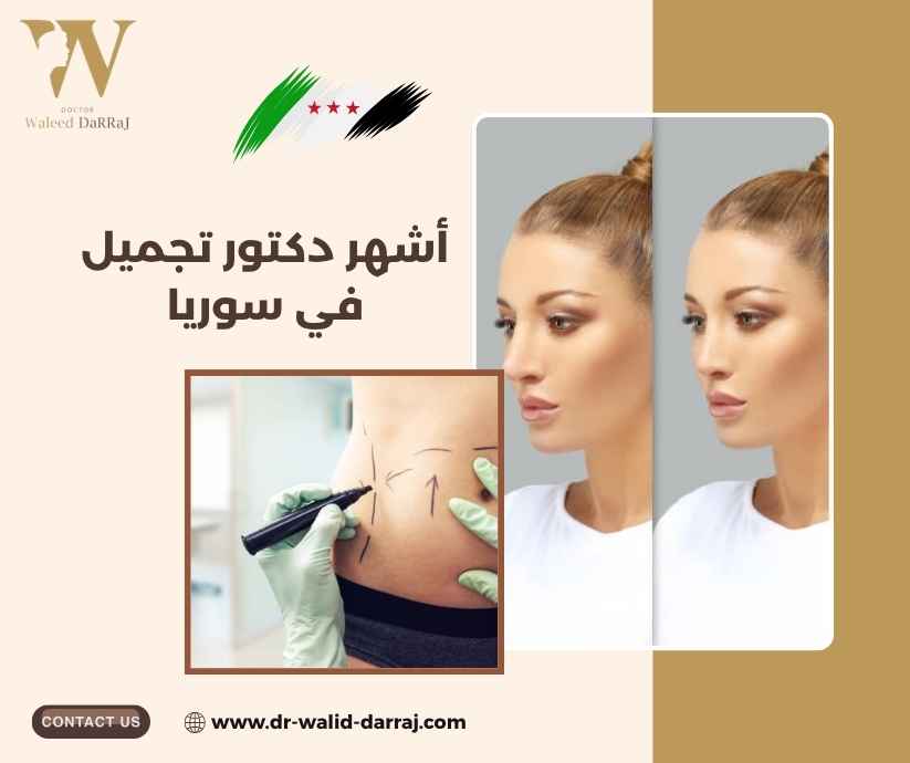 أشهر دكتور تجميل في سوريا