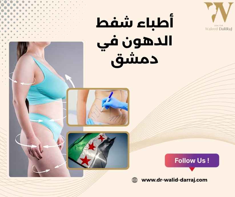 أطباء شفط الدهون في دمشق