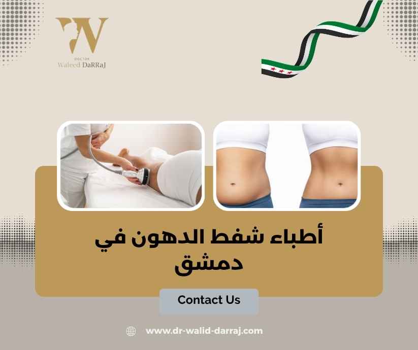 أطباء شفط الدهون في دمشق