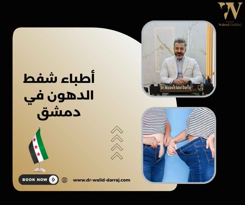 أطباء شفط الدهون في دمشق