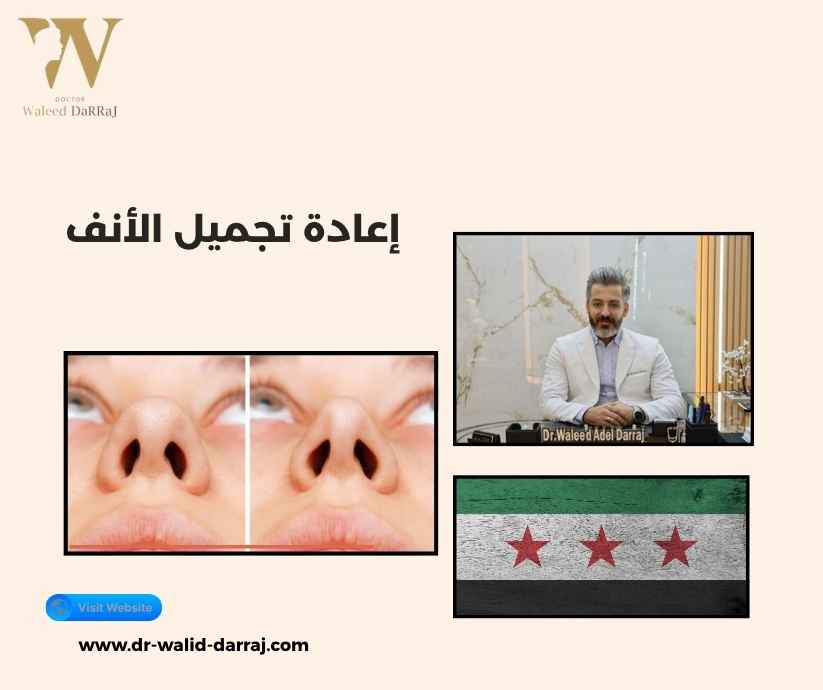 إعادة تجميل الأنف إعادة تجميل الأنف