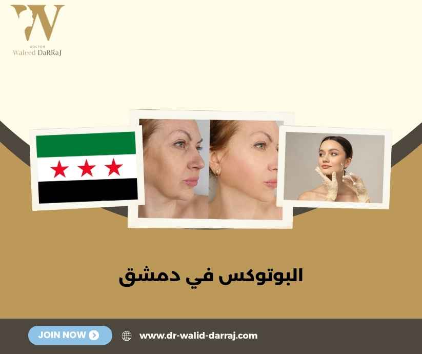 البوتوكس في دمشق