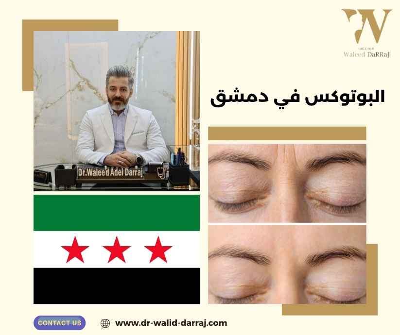البوتوكس في دمشق