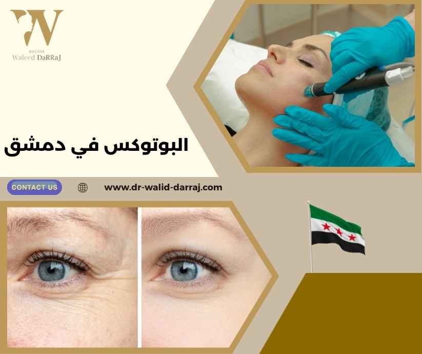 البوتوكس في دمشق