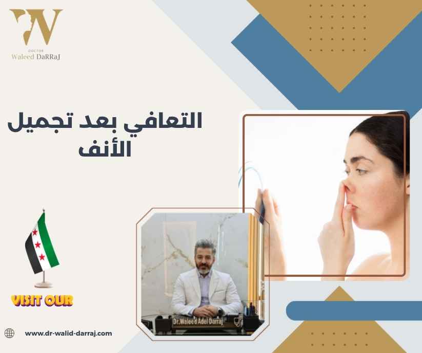 التعافي بعد تجميل الأنف