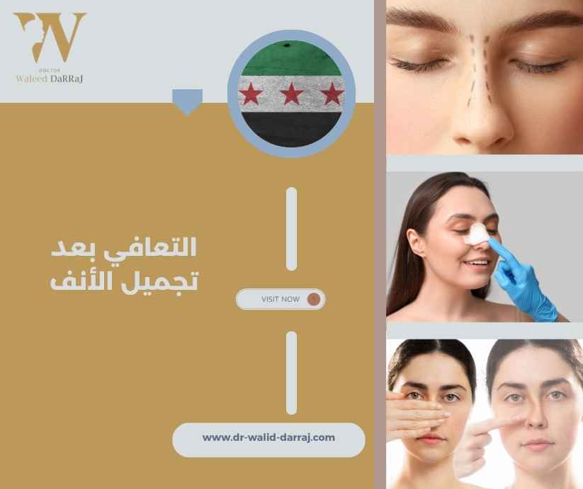 التعافي بعد تجميل الأنف