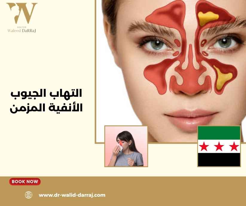 التهاب الجيوب الأنفية المزمن