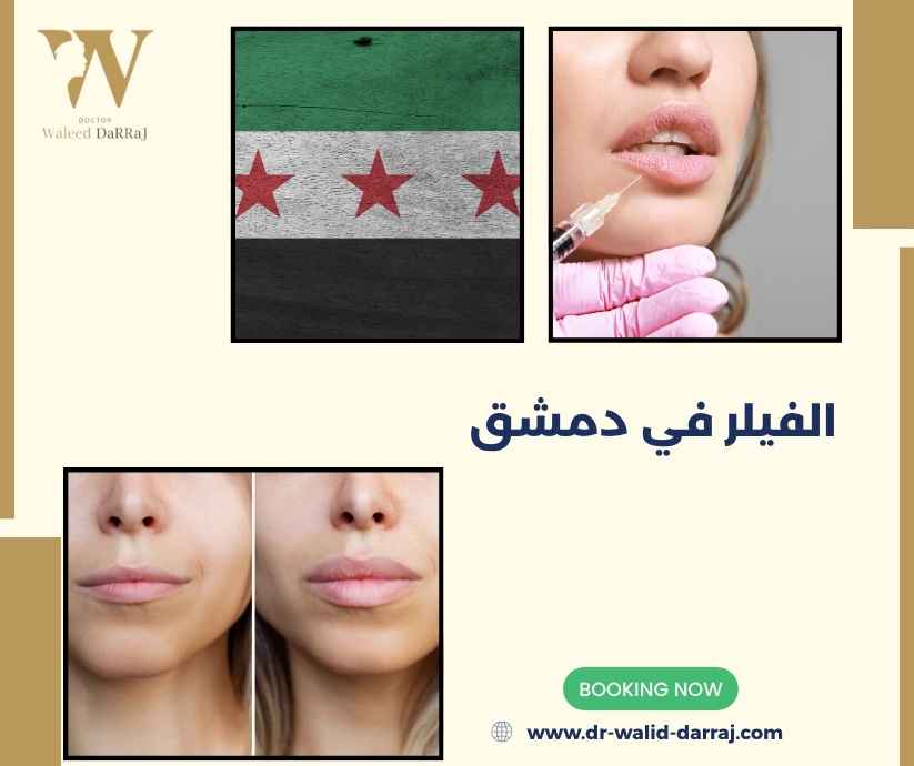 الفيلر في دمشق