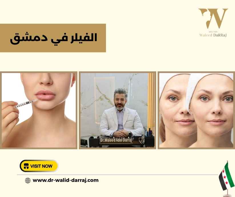 الفيلر في دمشق