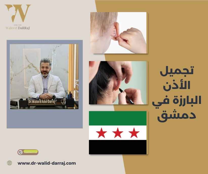 تجميل الأذن البارزة في دمشق