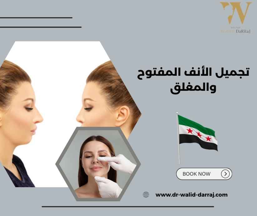 تجميل الأنف المفتوح والمغلق