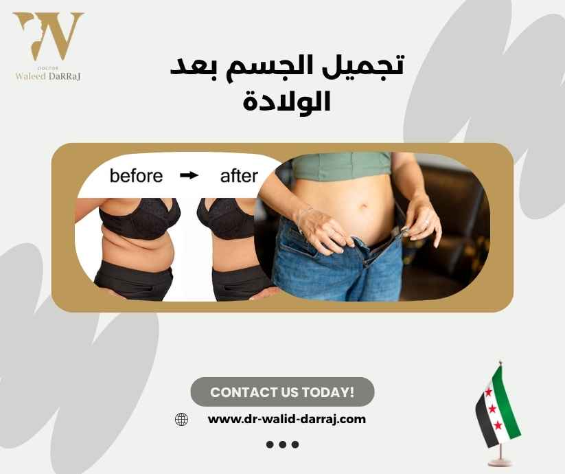 تجميل الجسم بعد الولادة