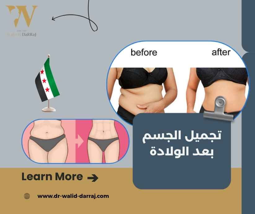 تجميل الجسم بعد الولادة