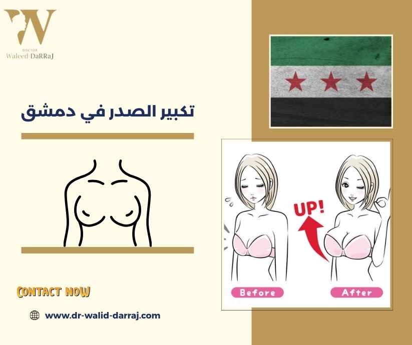 تكبير الصدر في دمشق
