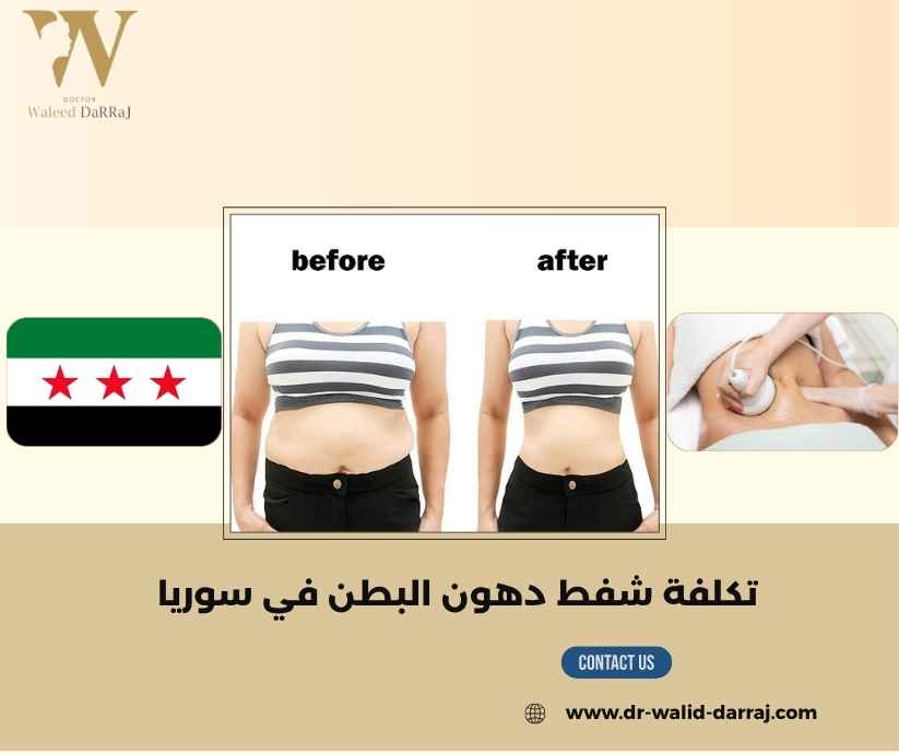 تكلفة شفط دهون البطن في سوريا