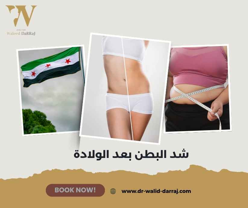 شد البطن بعد الولادة