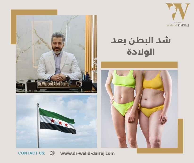 شد البطن بعد الولادة