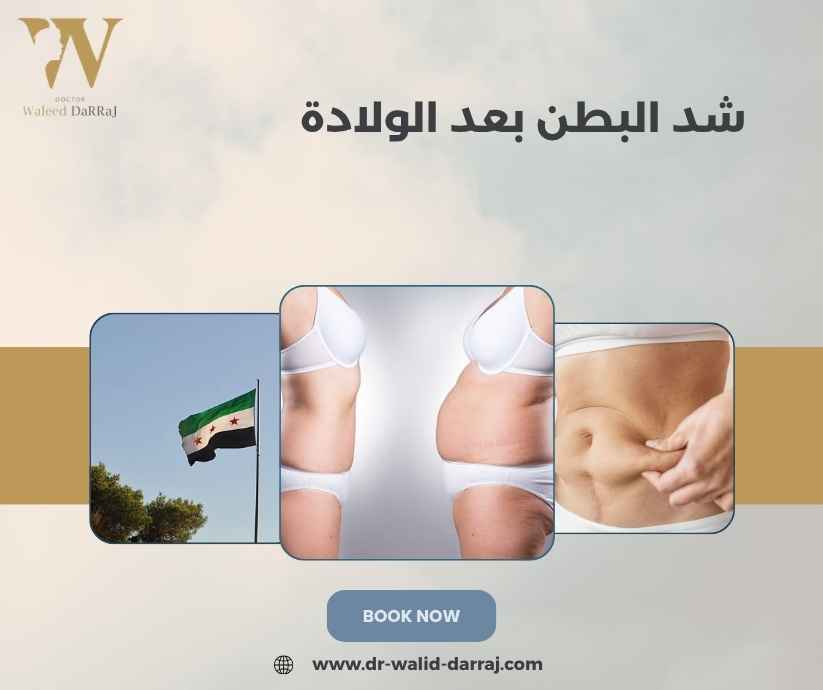 شد البطن بعد الولادة