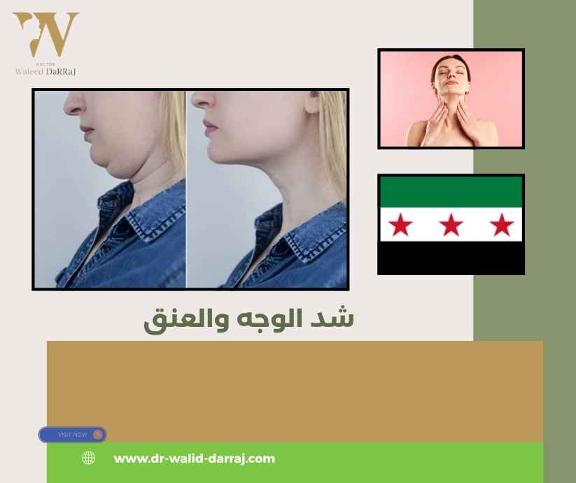 شد الوجه والعنق في دمشق