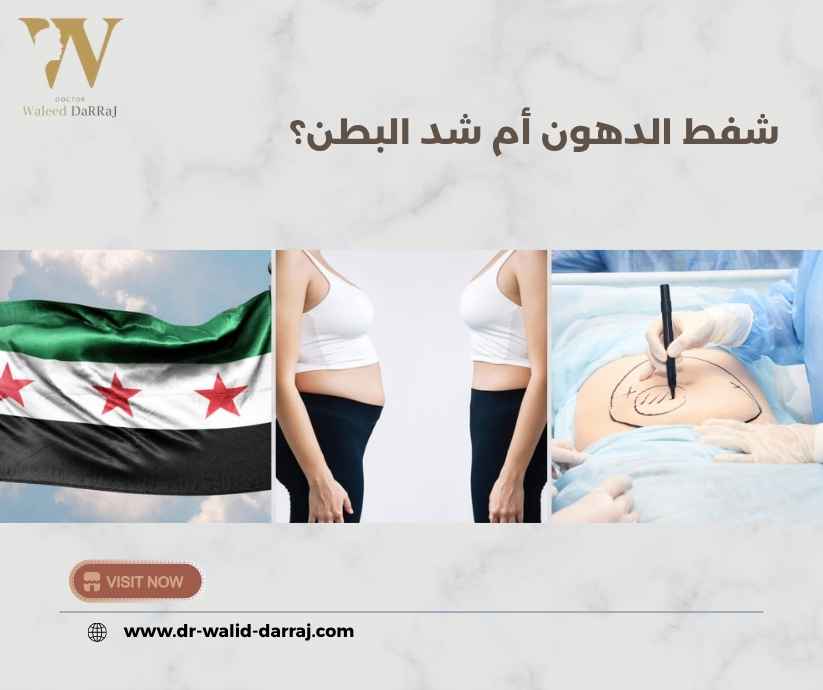 شفط الدهون أم شد البطن شفط الدهون أم شد البطن