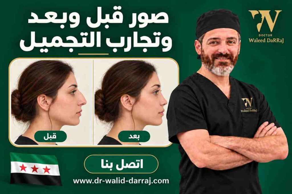 صور قبل وبعد وتجارب التجميل صور قبل وبعد وتجارب التجميل