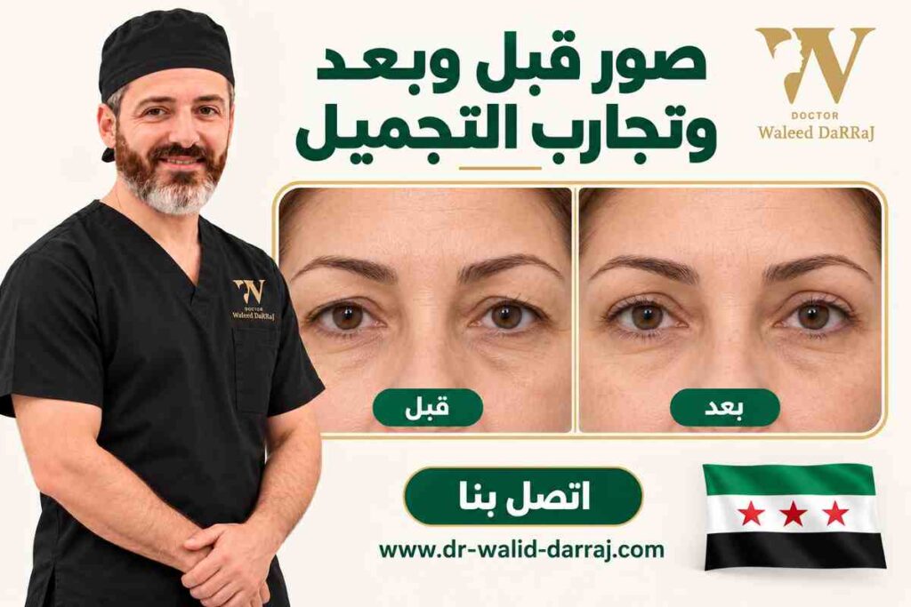 صور قبل وبعد وتجارب التجميل صور قبل وبعد وتجارب التجميل