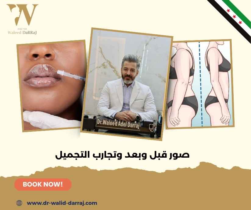 صور قبل وبعد وتجارب التجميل صور قبل وبعد وتجارب التجميل