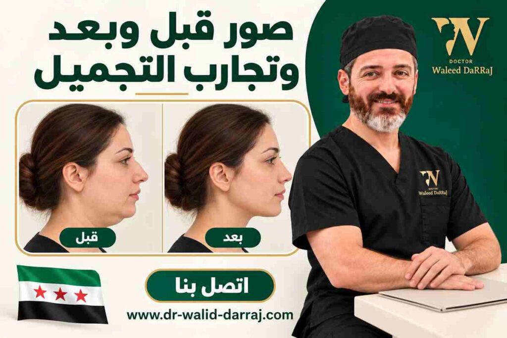 صور قبل وبعد وتجارب التجميل صور قبل وبعد وتجارب التجميل