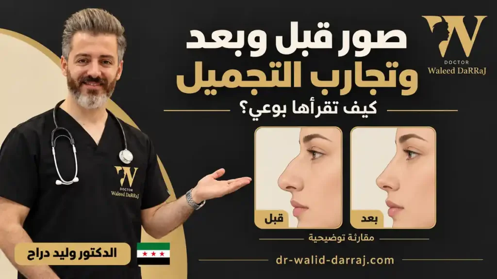 صور قبل وبعد وتجارب التجميل: كيف تقرأها بوعي؟