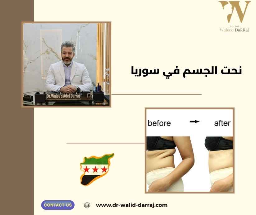 نحت الجسم في سوريا نحت الجسم في سوريا